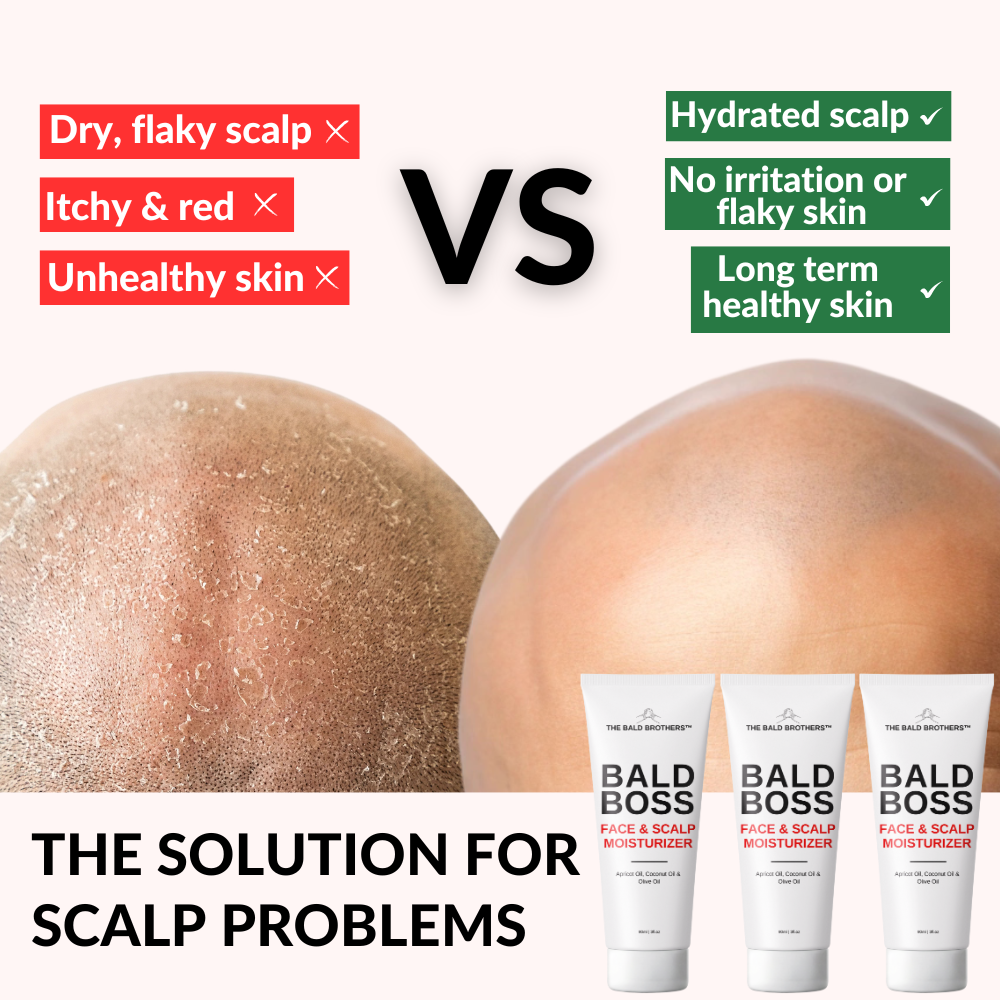 Bald Boss | Mattifying Bald Head Moisturizer