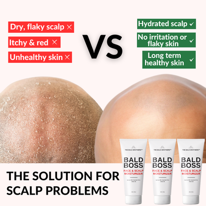Bald Boss 2 Pack | Mattifying Bald Head Moisturizer