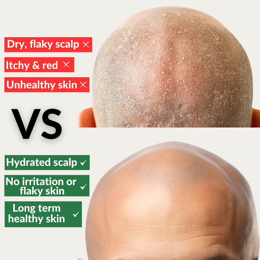 Bald Boss | Mattifying Bald Head Moisturizer